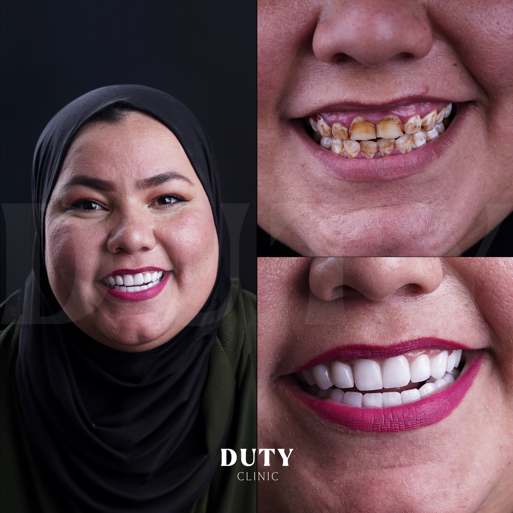 Teeth-Blog_2.jpg